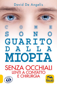COME SONO GUARITO DALLA MIOPIA - SENZA OCCHIALI LENTI A CONTATTO E CHIRURGIA