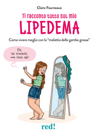 TI RACCONTO TUTTO SUL MIO LIPEDEMA