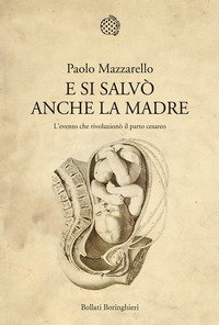E SI SALVO\' ANCHE LA MADRE - L\'EVENTO CHE RIVOLUZIONO\' IL PARTO CESAREO
