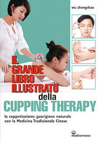 Grande libro illustrato della cupping therapy 