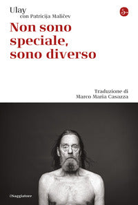 Non sono speciale sono diverso 