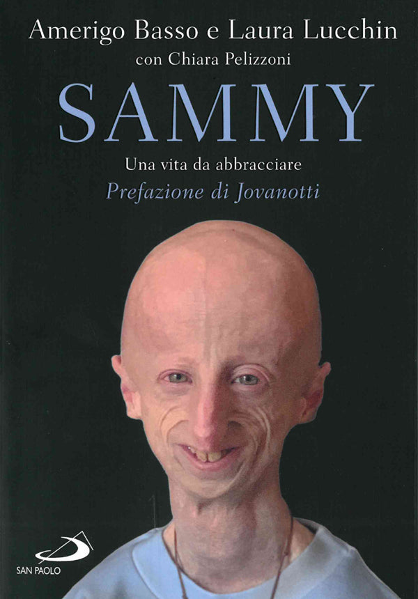 Sammy una vita da abbracciare 